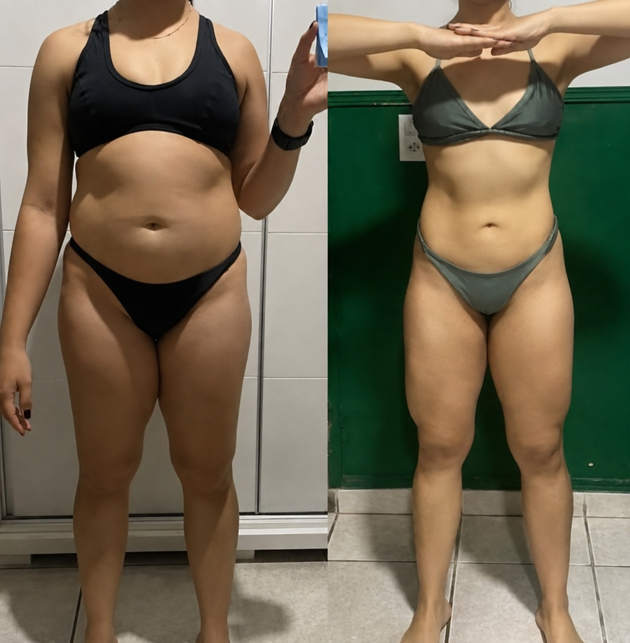 Antes e depois de Ana Paula, 38 anos — Menos volume na barriga e nas pernas